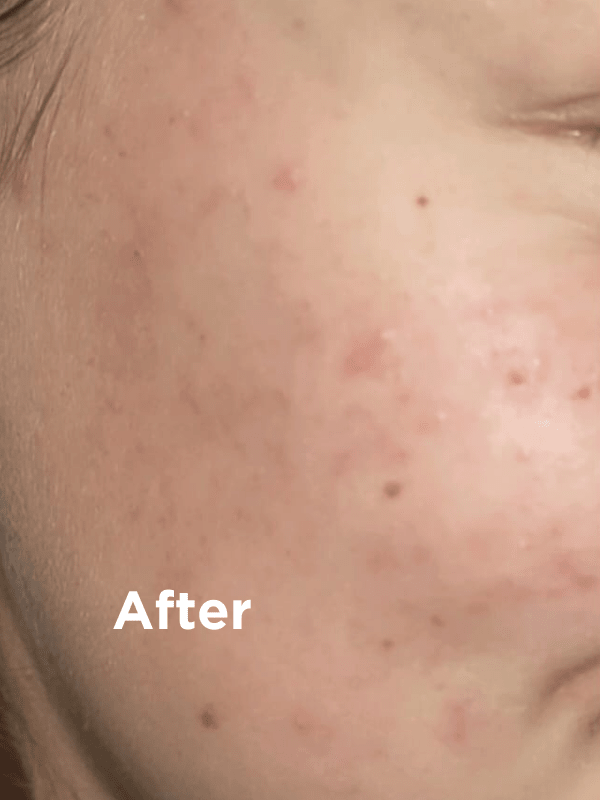 Sea Magik Rich Moisturiser 75 ml hvit i plast, nærbilde av hud med teksten "After