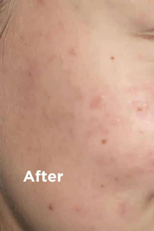 Sea Magik Mild Exfoliant - 75ml Sea Magik