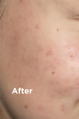 Sea Magik Mild Exfoliant - 75ml Sea Magik